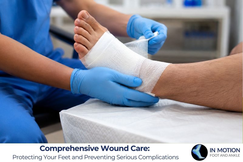 Comprehensive Wound Care: Protecting Your Feet and Preventing Serious Complications