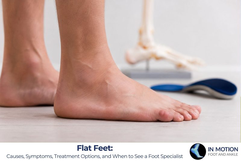 Flat Feet: Causes, Symptoms, Treatment Options, and When to See a Foot Specialist