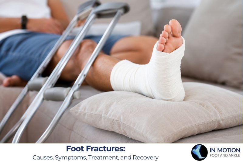 Foot Fractures: Causes, Symptoms, Treatment, and Recovery
