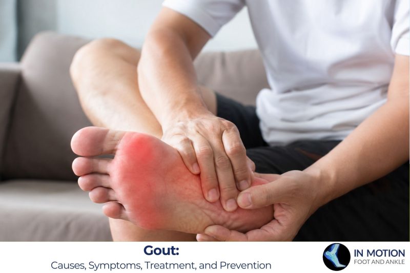 Gout: Causes, Symptoms, Treatment, and Prevention