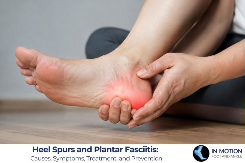 Heel Spurs and Plantar Fasciitis: Causes, Symptoms, Treatment, and Prevention