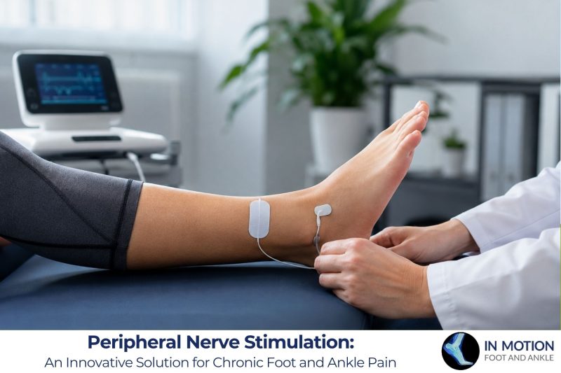 Peripheral Nerve Stimulation An Innovative Solution for Chronic Foot and Ankle Pain